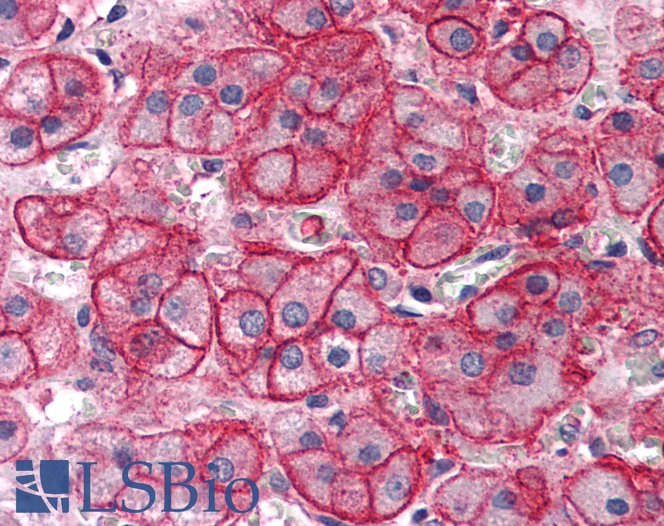 IHC-plus™ Polyclonal Rabbit anti-Human SLC1A4 / ASCT1 Antibody (C-Terminus, IHC)