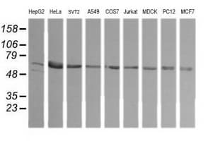 TAPBPL / TAPBPR Antibody (clone OTI2A4)