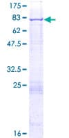 Human ACSF3 Protein (Recombinant GST)