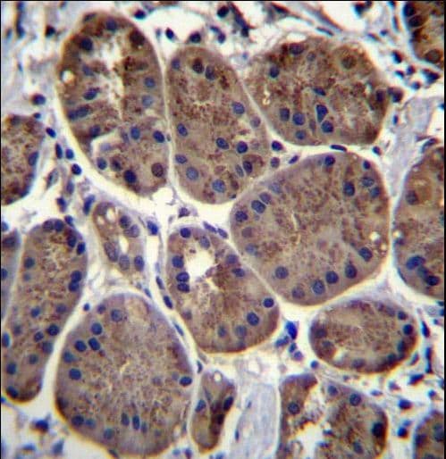 CLEC7A / Dectin 1 Antibody (aa70-98)
