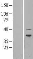 Human TRDMT1 / DNMT2 Protein (Over-Expression Lysate Myc-DDK (Flag))