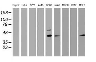PRR11 Antibody (aa125-360, clone OTI2A10, Carrier-free)