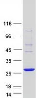 Human COMMD10 Protein (Recombinant Myc-DDK (Flag))