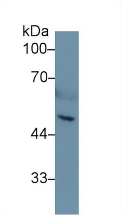 HPSE / Heparanase Antibody (aa280-412, APC)