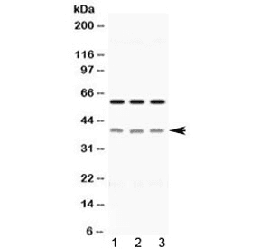 EPCAM Antibody
