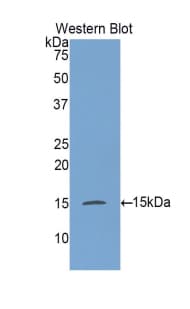 GALC / Galactocerebrosidase Antibody (aa38-156)