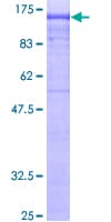 Human AP2B1 Protein (Recombinant GST)