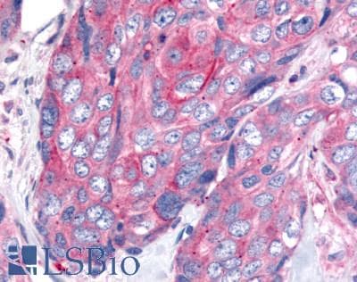 PathPlus™ WNT8A Antibody (Internal)