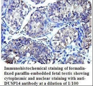 Polyclonal Rabbit anti-Human DUSP14 Antibody (aa2-198, IHC, WB)