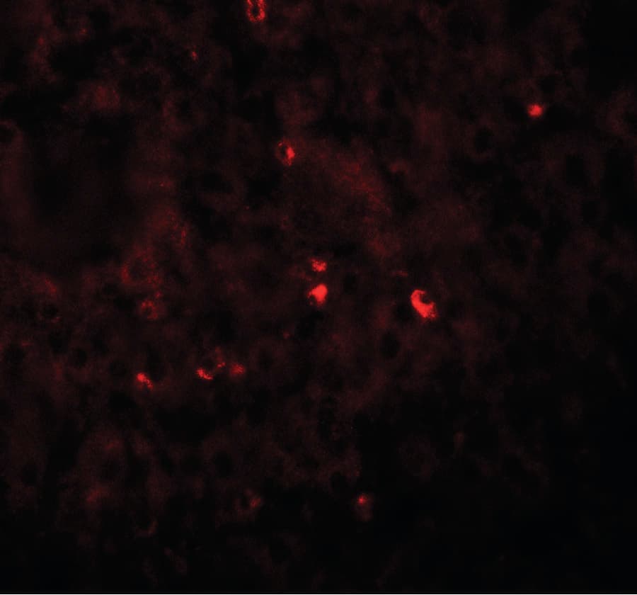 IHC-plus™ Angiogenin / ANG Antibody