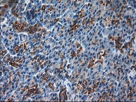 KRT18 / CK18 / Cytokeratin 18 Antibody (clone OTI1E1)