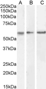 PathPlus™ CAMK2A / CaMKII Alpha Antibody (aa455-468)
