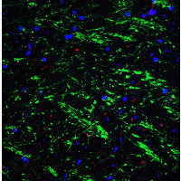 IHC-plus™ Polyclonal Rabbit anti-Human BAG1 / BAG-1 Antibody (IHC, IF, WB)