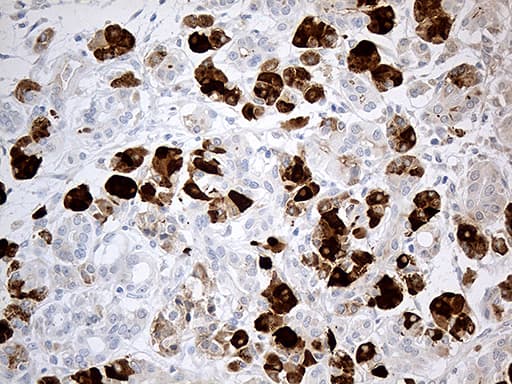 PNLIP / PL / Pancreatic Lipase Antibody (aa355-465, clone OTI5B9)