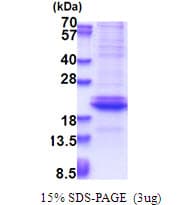 Human Adiponectin Protein (Recombinant His)
