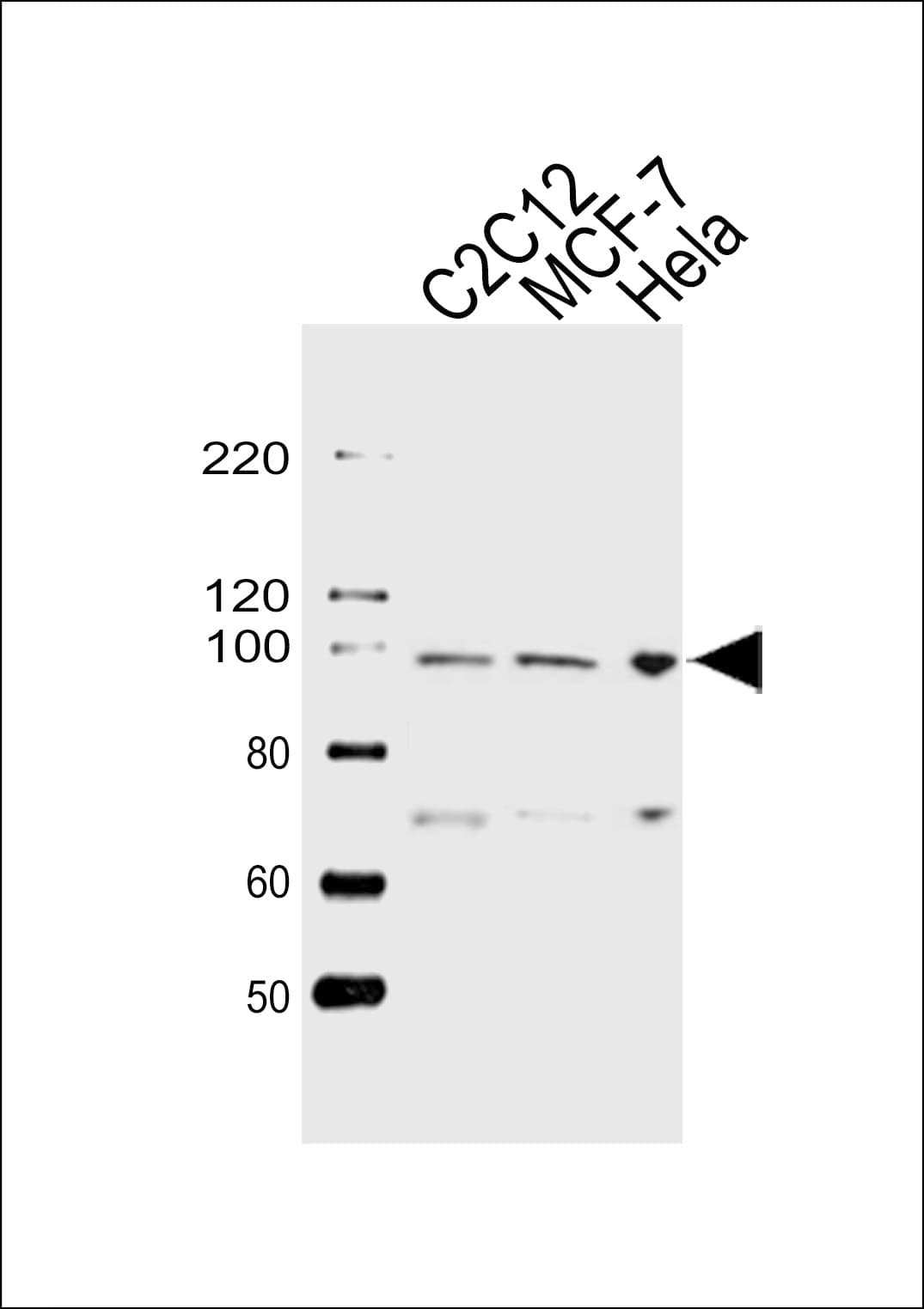 IHC-plus™ HSP90B1 / GP96 / GRP94 Antibody (aa460-487)
