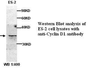 Polyclonal Rabbit anti-Human CCND1 / Cyclin D1 Antibody (C-Terminus, IHC, WB)