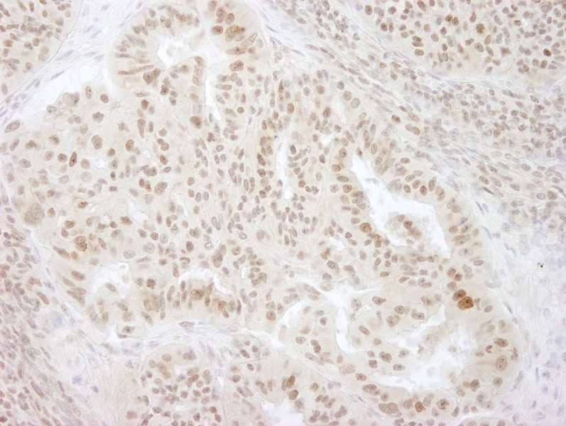 HSET / KIFC1 Antibody (aa625-673)