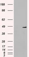 Monoclonal Mouse anti-Human MAP2K4 / MKK4 Antibody (clone OTI2E4, IHC, IF, WB)