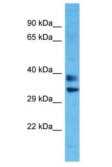 OR8H1 Antibody (aa262-311)