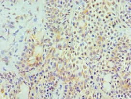 Polyclonal Rabbit anti-Human HYAL3 Antibody (aa198-417, IHC)