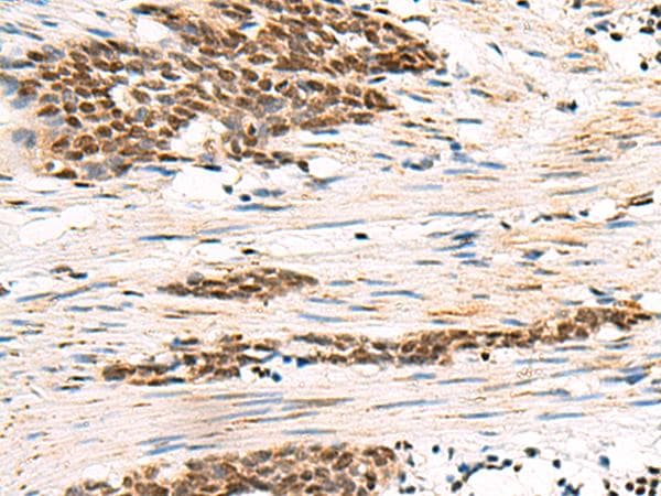 GABPB1 Antibody