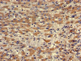 MTRF1 Antibody