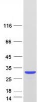 Human PARK7 / DJ-1 Protein (Recombinant Myc-DDK (Flag))