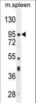 Polyclonal Rabbit anti-Human NSUN2 Antibody (aa423-451, WB)