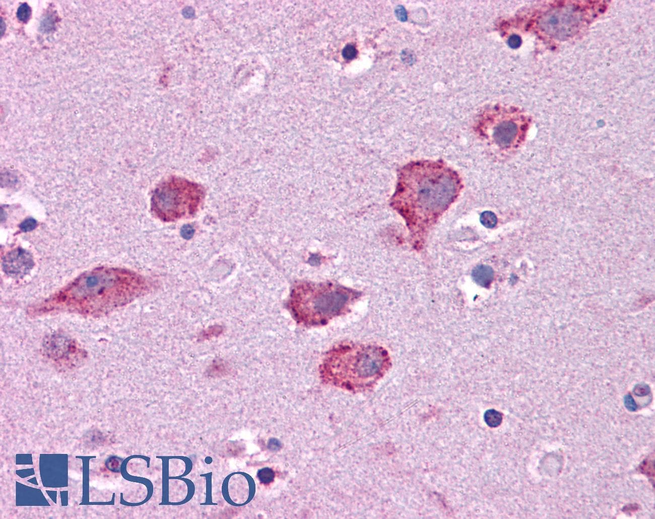 PathPlus™ HGF / Hepatocyte Growth Factor Antibody (aa216-265)