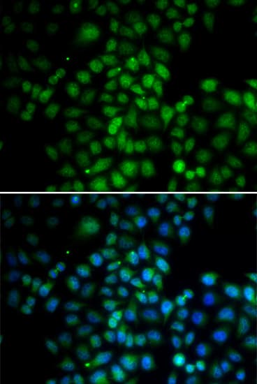 C11orf30 / EMSY Antibody