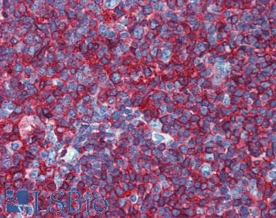 IHC-plus™ HLA-DP/DR Antibody (clone MEM-136)