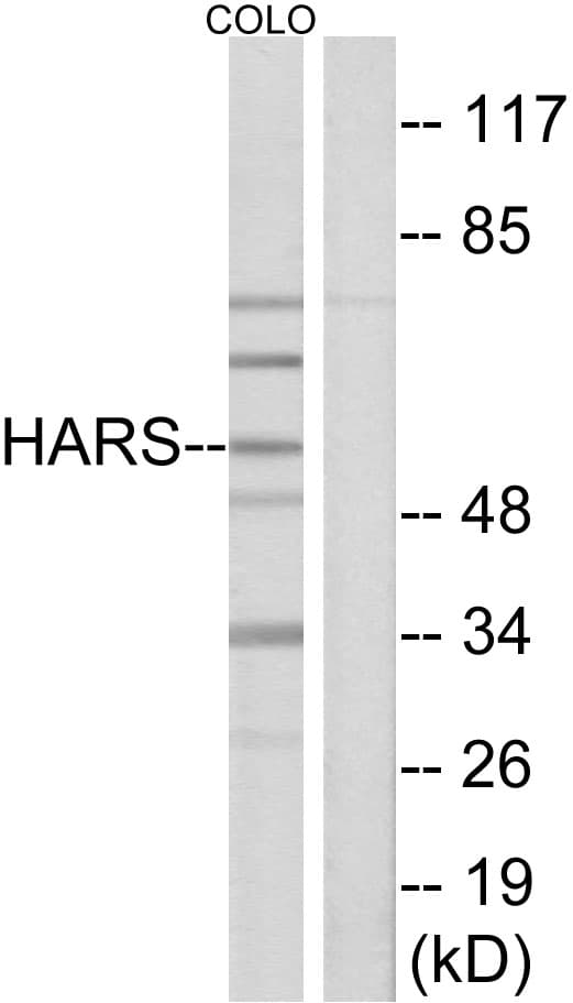 IHC-plus™ Polyclonal Rabbit anti-Human HARS Antibody (aa460-509, IHC, IF, WB)