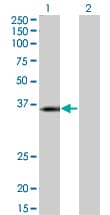 KCNJ15 / KIR4.2 Antibody (clone 1B2)