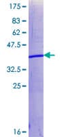 Human SUZ12 Protein (Recombinant GST, N-terminus)