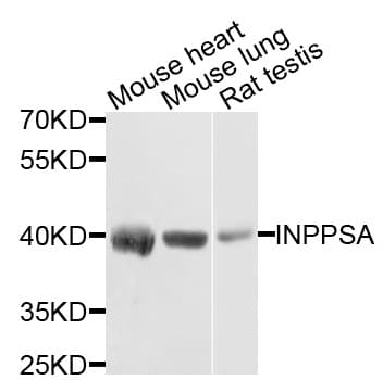 Polyclonal Rabbit anti-Human INPP5A Antibody (WB)