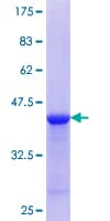 Human SCUBE3 Protein (Recombinant GST, N-terminus)