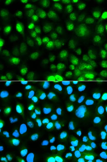 Polyclonal Rabbit anti-Human ATXN3 / JOS Antibody (IHC, IF, WB)