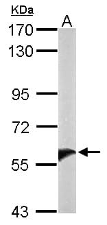 UGT1A9 Antibody (aa291-530)