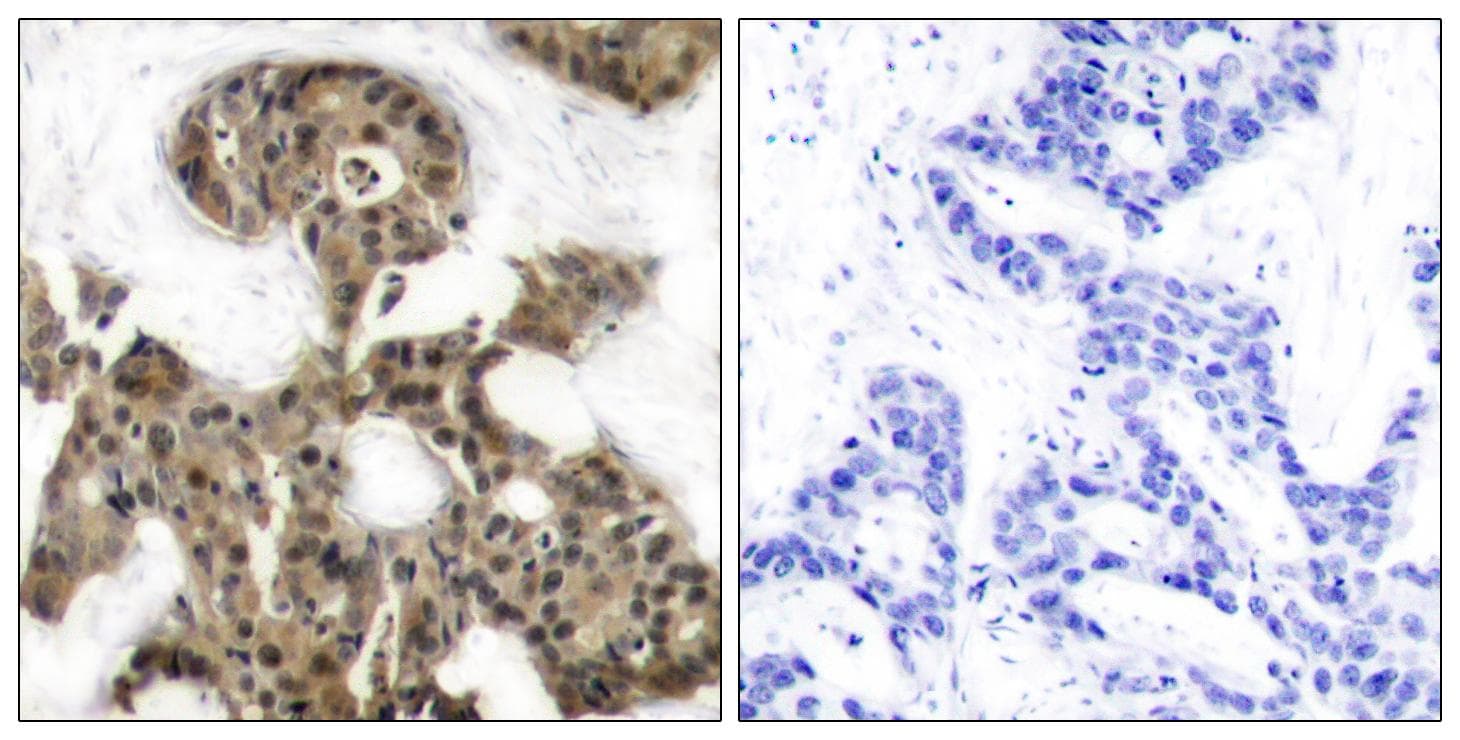 EIF4EBP1 / 4EBP1 Antibody (p45)