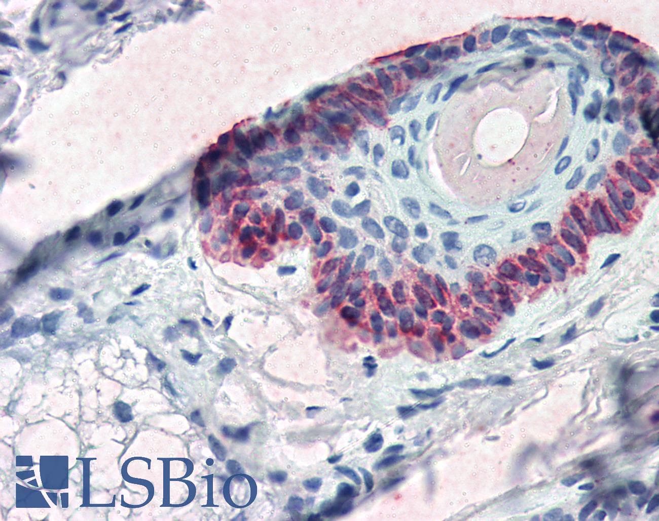 IHC-plus™ KRT15 / CK15 / Cytokeratin 15 Antibody (C-Terminus, clone 15K01)