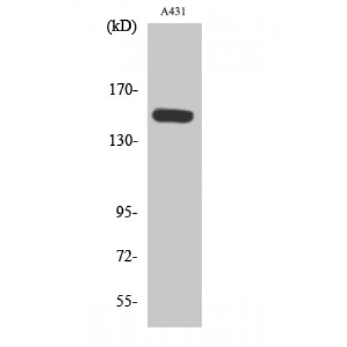 PLCB3 Antibody (1040-1120 aa)