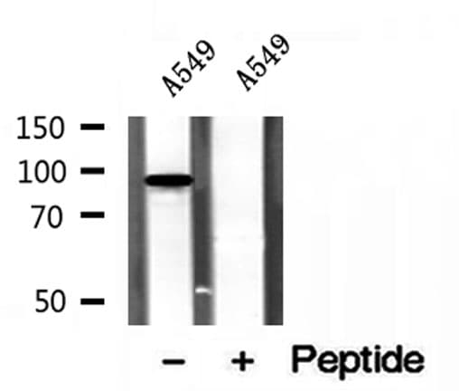 PBXIP1 / HPIP Antibody