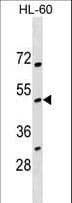 Polyclonal Rabbit anti-Human NOXO1 Antibody (aa192-219, WB)