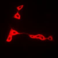 Polyclonal Rabbit anti-Human HLA-DRB1 Antibody (IF, WB)