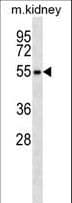 RPS6KL1 Antibody