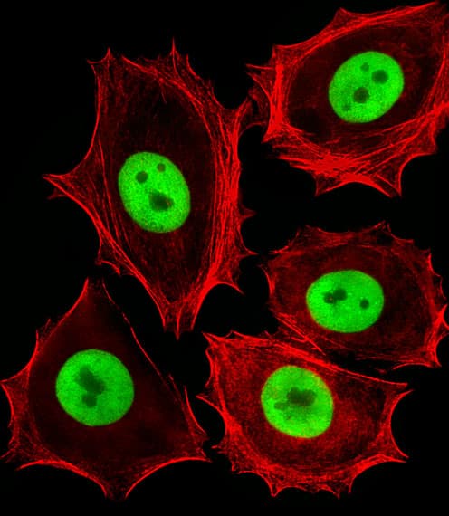 CDK4 Antibody (aa272-303)