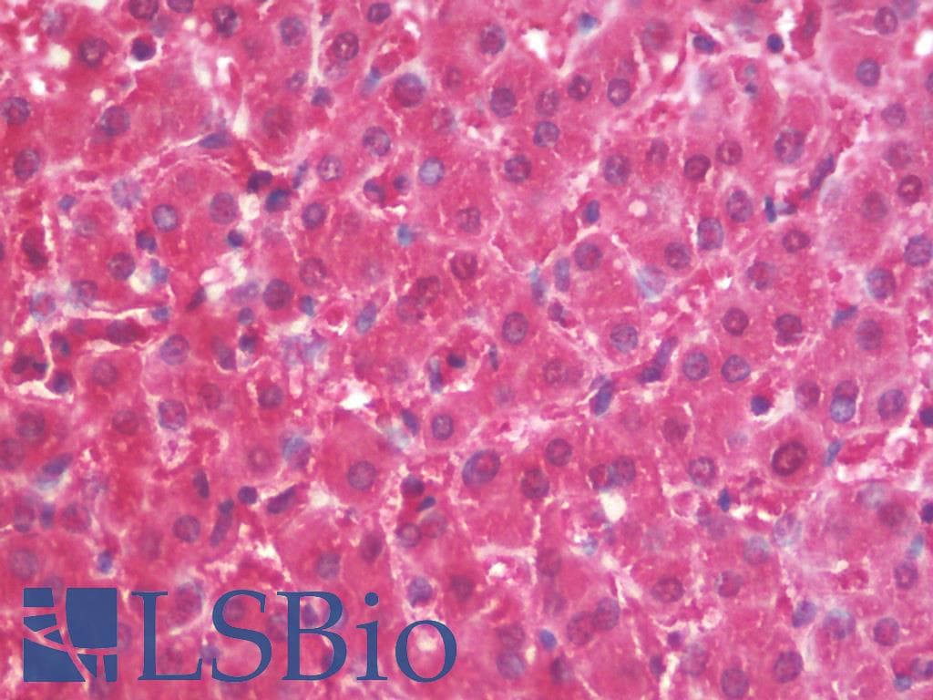 IHC-plus™ ALDOB Antibody (aa111-160)