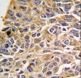 RIPK3 / RIP3 Antibody (aa1-30)