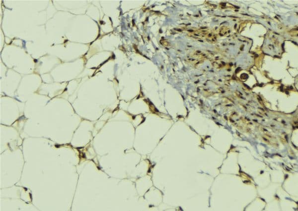Polyclonal Rabbit anti-Human MBIP Antibody (IHC, WB)